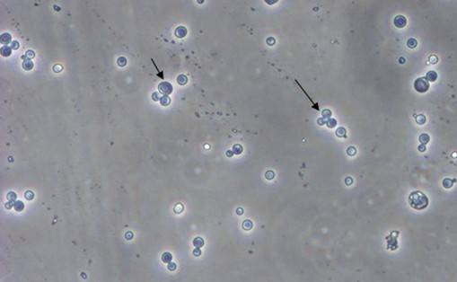 酵母双杂交手艺原理、、试验流程、、特点以及应用