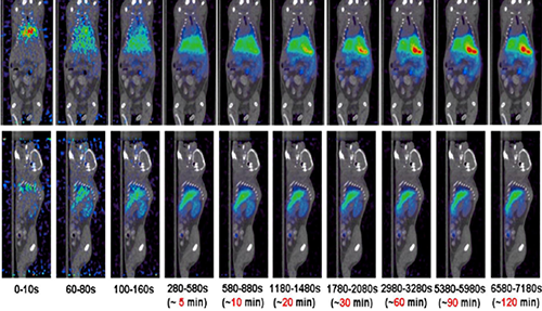Ladbrokes立博PET/CT分子影像手艺平台