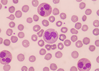 一种神秘颗粒被发明了！它能否成为败血症早筛标记物？？？