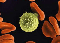 Science子刊：：：一种FDA批准的抗腹泻药物可有用反抗化疗的耐药性