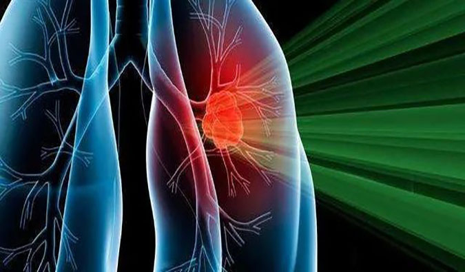 盛世泰科1类立异药物CGT-9475实现中美双报双批 | Ladbrokes立博一站式临床宿世物医药研发服务平台助力